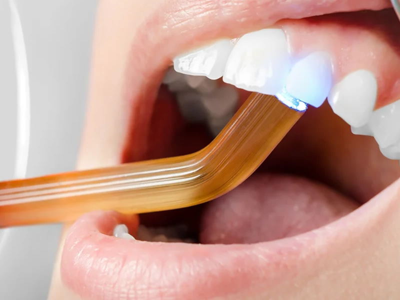 Estetik Dolgu Tedavisi